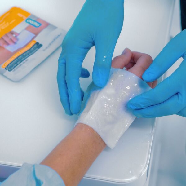 AEROBURN Burn Gel Dressing 10 x 10cm - Image 3