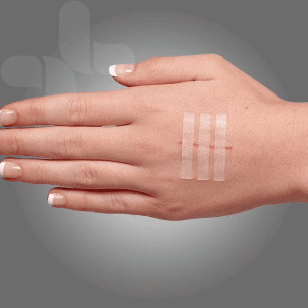 AEROPLAST Wound Closure Strips 6 x 75mm 3 strips/card Box/50 - Image 3