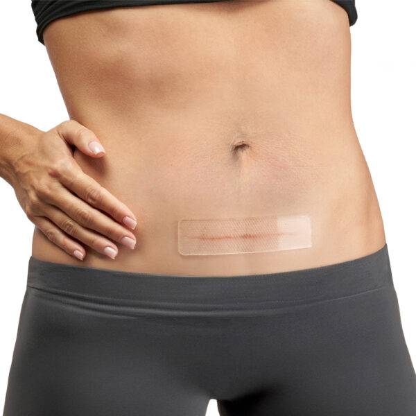 AeroScar Silicone Scar Sheets 3 cm x 12 cm Box/2 - Image 3
